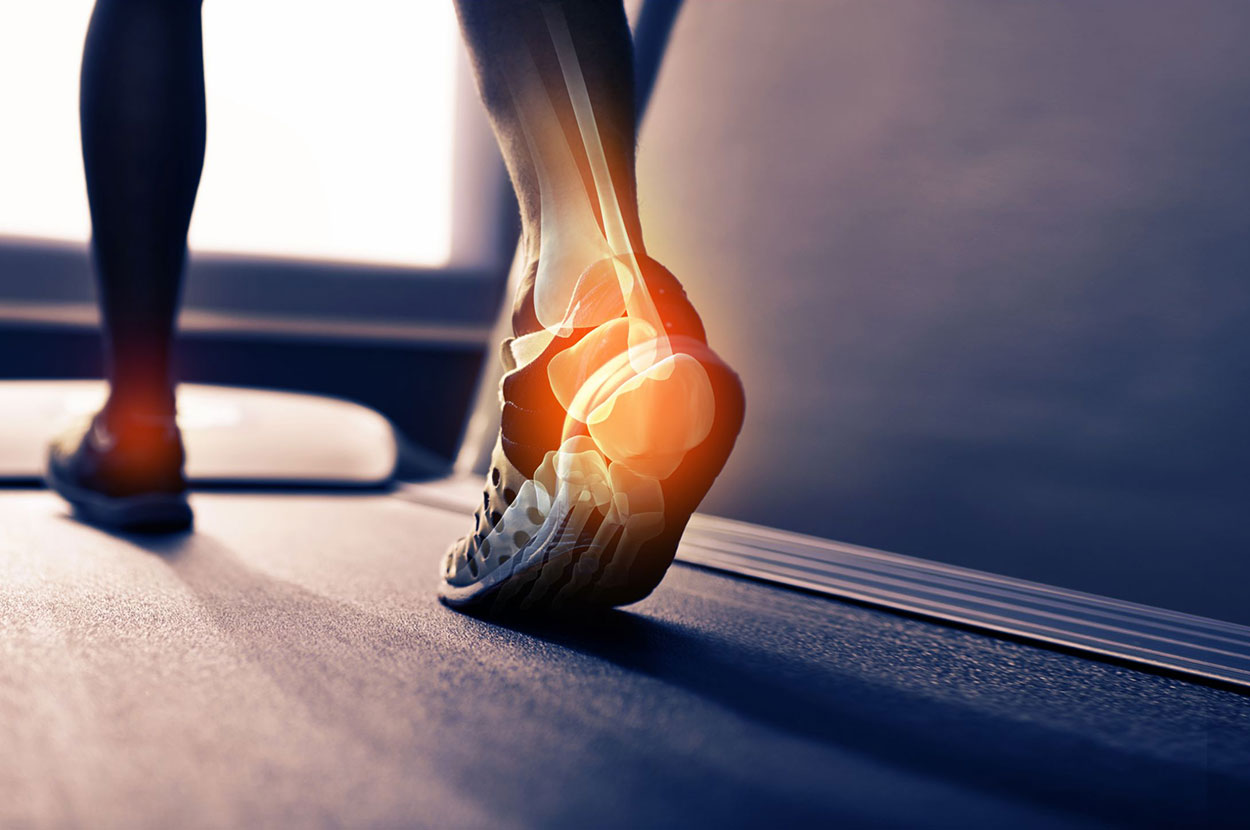 Heel Pain / Plantarfasciitis 